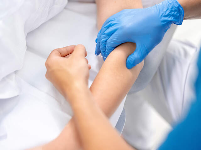 Dry Needling